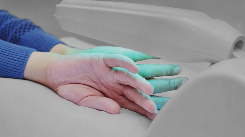 Psoriasis Treatments: How UVB Light Helps You To Get Rid Of Psoriasis