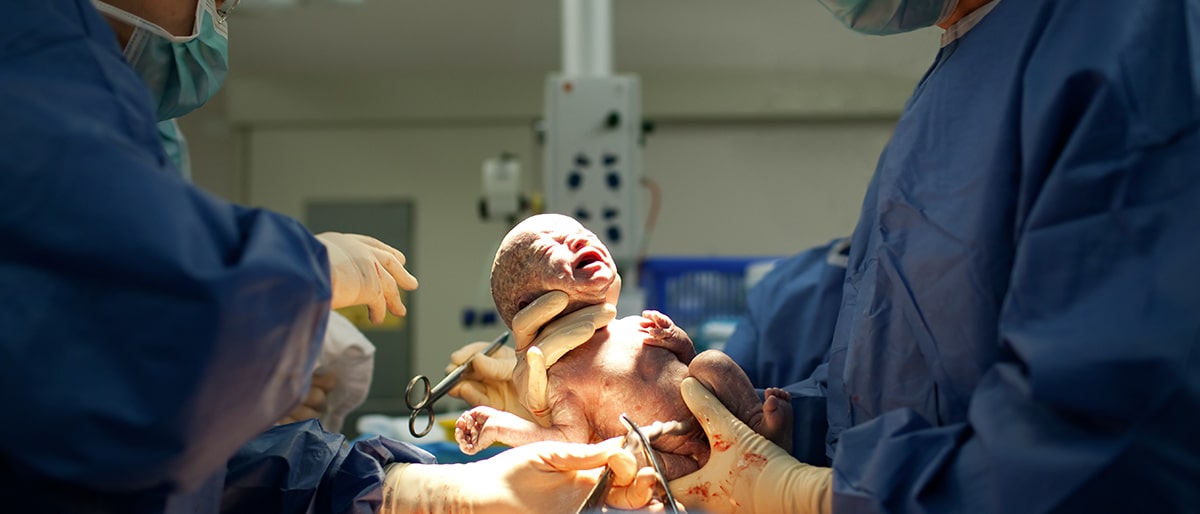 5 Considerations When Choosing The Right Birth Malpractice Lawyer In Times Of Great Stress