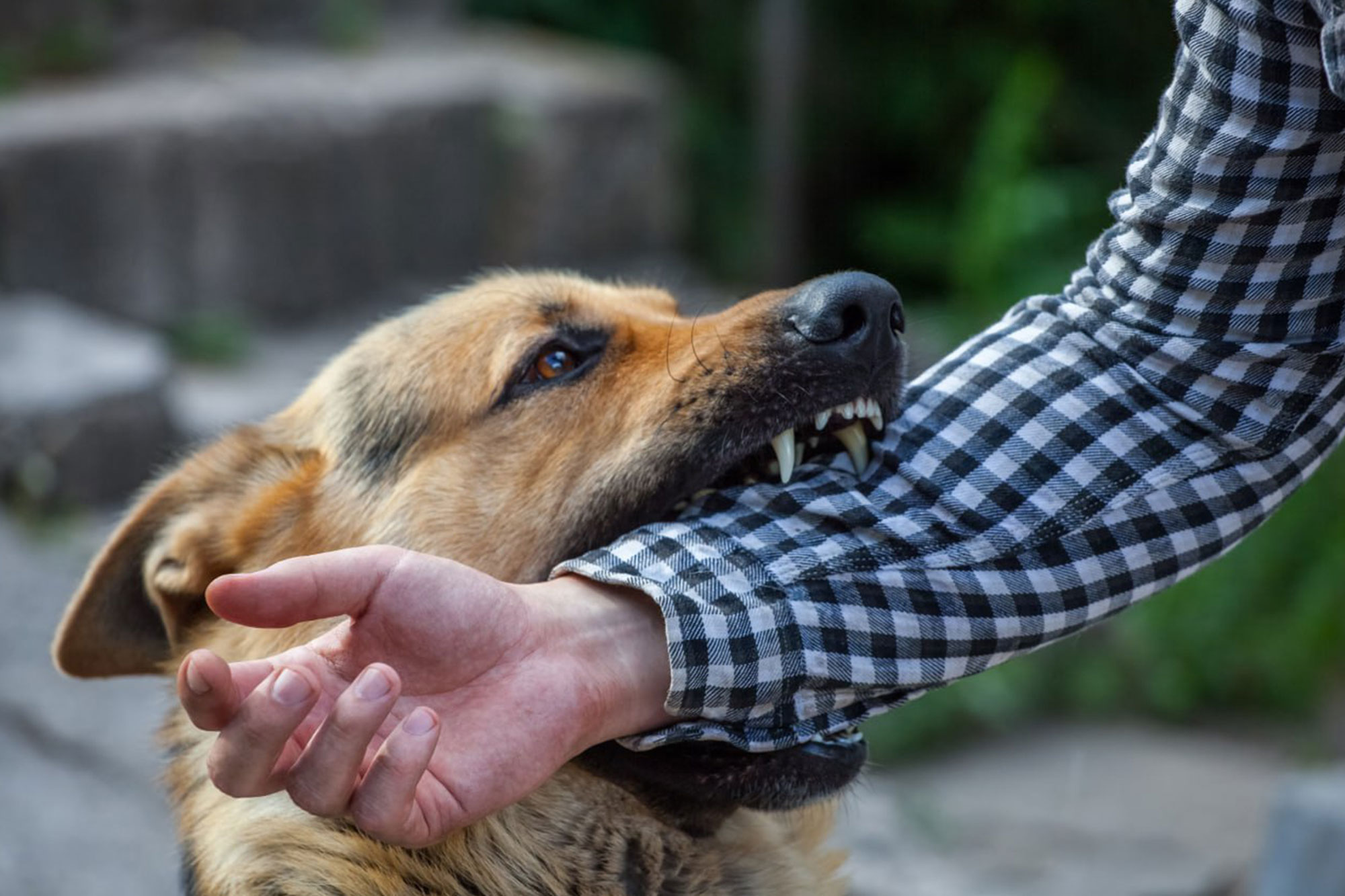 What To Expect During A Legal Consultation After A Serious Animal Attack