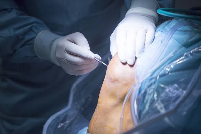 Questions Patients May Ask An Orthopaedic Specialist About Meniscus Tears